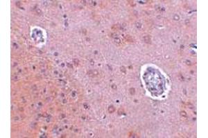 Immunohistochemical staining of rat brain tissue with 2. (FAM120A anticorps  (Internal Region))