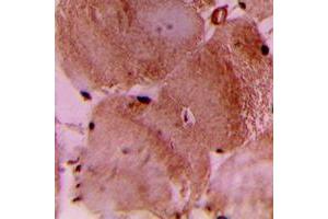 Immunohistochemical analysis of cTnI staining in human heart formalin fixed paraffin embedded tissue section.