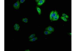 Immunofluorescence staining of HepG2 cells with ABIN7169938 at 1:100, counter-stained with DAPI.