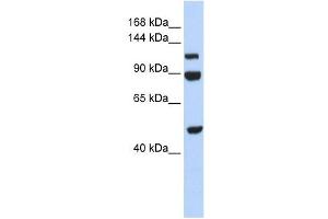 NARG1L antibody used at 1 ug/ml to detect target protein. (NARG1L anticorps  (Middle Region))