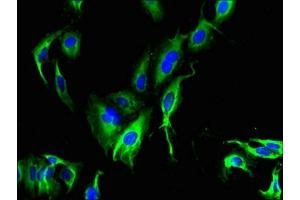 Immunofluorescent analysis of Hela cells using ABIN7147035 at dilution of 1:100 and Alexa Fluor 488-congugated AffiniPure Goat Anti-Rabbit IgG(H+L) (CATSPER4 anticorps  (AA 306-472))