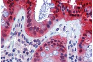 Human Colon (formalin-fixed, paraffin-embedded) stained with CASP7 antibody ABIN462356 followed by biotinylated anti-mouse IgG secondary antibody ABIN481714, alkaline phosphatase-streptavidin and chromogen.