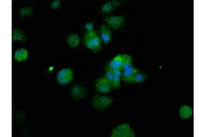 Immunofluorescence staining of MCF-7 cells with ABIN7150380 at 1:200, counter-stained with DAPI. (RFX2 anticorps  (AA 1-130))