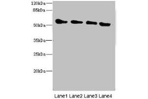 Western blot All lanes: TRHDE antibody at 1. (TRHDE anticorps  (AA 62-200))