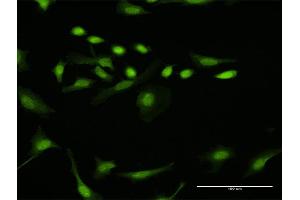 Immunofluorescence of purified MaxPab antibody to DTL on HeLa cell. (CDT2/RAMP anticorps  (AA 1-730))