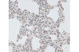 Immunohistochemistry of paraffin-embedded Rat lung using ZNF148 Polyclonal Antibody at dilution of 1:100 (40x lens). (ZNF148 anticorps)