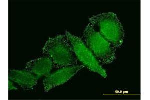 Immunofluorescence of monoclonal antibody to IL1B on HeLa cell.