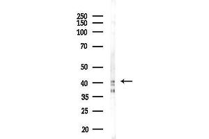 anti-Gastrin-Releasing Peptide Receptor (GRPR) (Internal Region) antibody