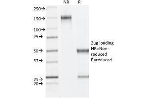 SDS-PAGE Analysis Purified ER-beta Mouse Monoclonal Antibody (ESR2/686). (ESR2 anticorps  (C-Term))