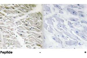 Immunohistochemical analysis of paraffin-embedded human heart tissue using PPP1R14A polyclonal antibody . (CPI-17 anticorps)