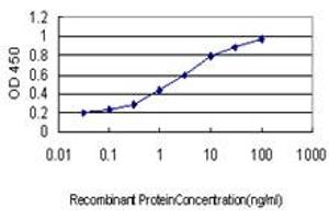 Detection limit for recombinant GST tagged FBXL10 is approximately 0.