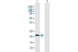 Western Blot analysis of FKBP11 expression in transfected 293T cell line by FKBP11 MaxPab polyclonal antibody. (FKBP11 anticorps  (AA 1-201))