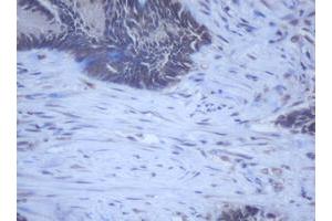 Image no. 10 for anti-DEAD (Asp-Glu-Ala-Asp) Box Polypeptide 59 (DDX59) (AA 1-303) antibody (ABIN1490728) (DDX59 anticorps  (AA 1-303))