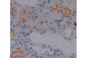 Figure. (Uromodulin anticorps  (AA 334-589))