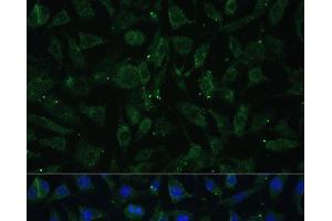 Immunofluorescence analysis of L929 cells using APH1A Polyclonal Antibody at dilution of 1:100 (40x lens).