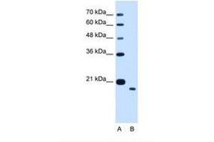 Image no. 1 for anti-Transmembrane Protein 91 (TMEM91) (AA 51-100) antibody (ABIN341306) (TMEM91 anticorps  (AA 51-100))