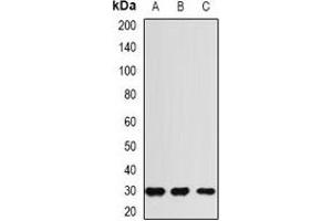 Western blot analysis of RGR expression in HEK293T (A), mouse liver (B), rat heart (C) whole cell lysates. (RGR anticorps)
