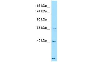 Western Blotting (WB) image for anti-Latent Transforming Growth Factor beta Binding Protein 4 (LTBP4) (C-Term) antibody (ABIN2789916)