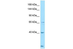 Western Blotting (WB) image for anti-Latent Transforming Growth Factor beta Binding Protein 4 (LTBP4) (C-Term) antibody (ABIN2789916) (LTBP4 anticorps  (C-Term))