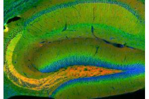 Indirect immunohistochemistry of a rat hippocampus section with rabbit anti-amphiphysin (cat.