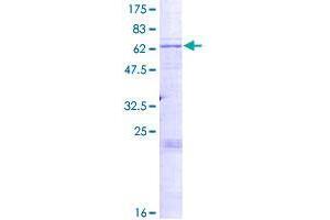 Image no. 1 for ST8 alpha-N-Acetyl-Neuraminide alpha-2,8-Sialyltransferase 3 (ST8SIA3) (AA 1-380) protein (GST tag) (ABIN1321528)