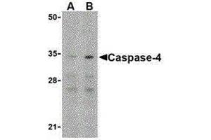 Western Blotting (WB) image for anti-Caspase 4, Apoptosis-Related Cysteine Peptidase (CASP4) (N-Term) antibody (ABIN2477914) (Caspase 4 anticorps  (N-Term))
