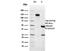 SDS-PAGE Analysis Purified Napsin A Mouse Monoclonal Antibody (NAPSA/3308). (NAPSA anticorps  (AA 189-299))