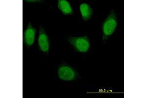 Immunofluorescence of monoclonal antibody to PRDM1 on HeLa cell. (PRDM1 anticorps  (AA 422-493))