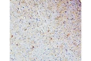 IHC analysis of SMARCAD1 using anti-SMARCAD1 antibody (ABIN6719539).