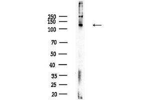 Western blot analysis of lysates from HepG2 cells(heat-shock treatment), using Phospho-FAK (Ser843) Antibody at 1/1000 dilution.