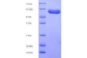 SDS-PAGE (SDS) image for L-2-Hydroxyglutarate Dehydrogenase (L2HGDH) (AA 53-463) protein (His-SUMO Tag) (ABIN5709837)