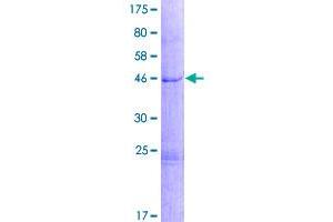 Image no. 1 for Phosphatidylinositol-4-Phosphate 5-Kinase-Like 1 (PIP5KL1) (AA 1-191) protein (GST tag) (ABIN1315151)