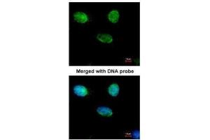 ICC/IF Image Immunofluorescence analysis of paraformaldehyde-fixed HeLa, using MCM3, antibody at 1:500 dilution. (MCM3 anticorps)