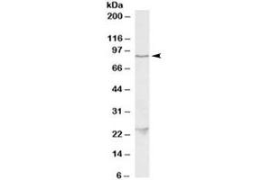 Western blot testing of HeLa lysate with TBK1 antibody at 1ug/ml. (TBK1 anticorps)