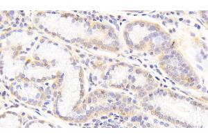 Detection of HSPG2 in Porcine Stomach Tissue using Polyclonal Antibody to Heparan Sulfate Proteoglycan 2 (HSPG2)