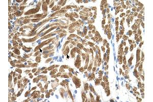 PEX10 antibody was used for immunohistochemistry at a concentration of 4-8 ug/ml to stain Skeletal muscle cells (arrows) in Human Muscle. (PEX10 anticorps  (Middle Region))