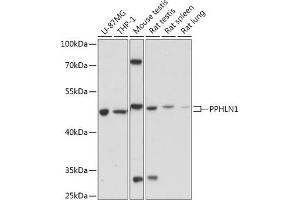 Western blot analysis of extracts of various cell lines, using PPHLN1 antibody (ABIN7269229) at 1:1000 dilution. (PPHLN1 anticorps  (AA 195-255))