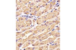 Immunohistochemical analysis of paraffin-embedded H. (Glutathione Synthetase anticorps  (C-Term))