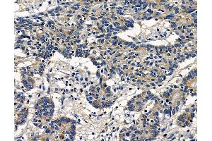 anti-Diffuse Panbronchiolitis Critical Region 1 (DPCR1) antibody