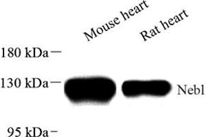 Western blot analysis of Nebulette (ABIN7074788) at dilution of 1: 2000
