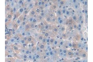 DAB staining on IHC-P; Samples: Rat Liver Tissue (RANKL anticorps  (AA 106-240))
