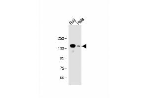 All lanes : Anti-UBE4B Antibody (N-term) at 1:1000 dilution Lane 1: Raji whole cell lysate Lane 2: Hela whole cell lysate Lysates/proteins at 20 μg per lane. (UBE4B anticorps  (N-Term))