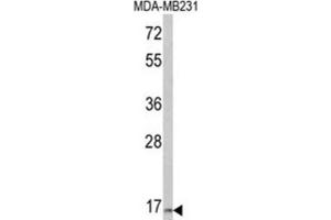 Western Blotting (WB) image for anti-Thyroid Stimulating Hormone, beta (TSHB) antibody (ABIN3003835) (TSHB anticorps)