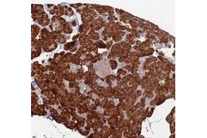 Immunohistochemical staining of human pancreas with TRAPPC6A polyclonal antibody  shows strong cytoplasmic positivity in exocrine glandular cells. (TRAPPC6A anticorps)