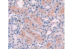Used in DAB staining on fromalin fixed paraffin- embedded Kidney tissue