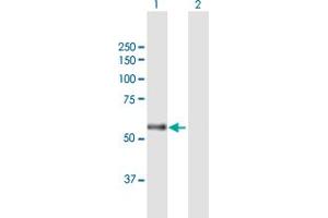 Western Blot analysis of CARD14 expression in transfected 293T cell line by CARD14 MaxPab polyclonal antibody. (CARD14 anticorps  (AA 1-434))