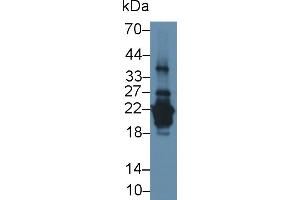 Detection of PRH2 in Human Saliva using Polyclonal Antibody to Acidic Salivary Proline Rich Phosphoprotein 2 (PRH2) (PRH2 anticorps  (AA 17-166))