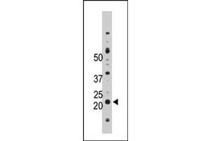 The NME4 polyclonal antibody  is used in Western blot to detect NME4 in Jurkat cell lysate. (NME4 anticorps  (C-Term))