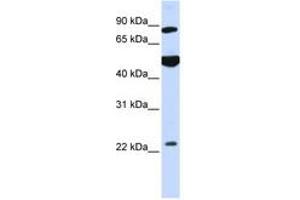 Image no. 1 for anti-Mannosyl-Oligosaccharide Glucosidase (MOGS) (AA 144-193) antibody (ABIN6740983) (GCS1 anticorps  (AA 144-193))