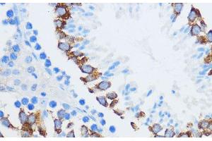 Immunohistochemistry of paraffin-embedded Mouse testis using IGF2BP3 Polyclonal Antibody at dilution of 1:100 (40x lens). (IGF2BP3 anticorps)